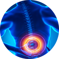 Treatment for Back Pain